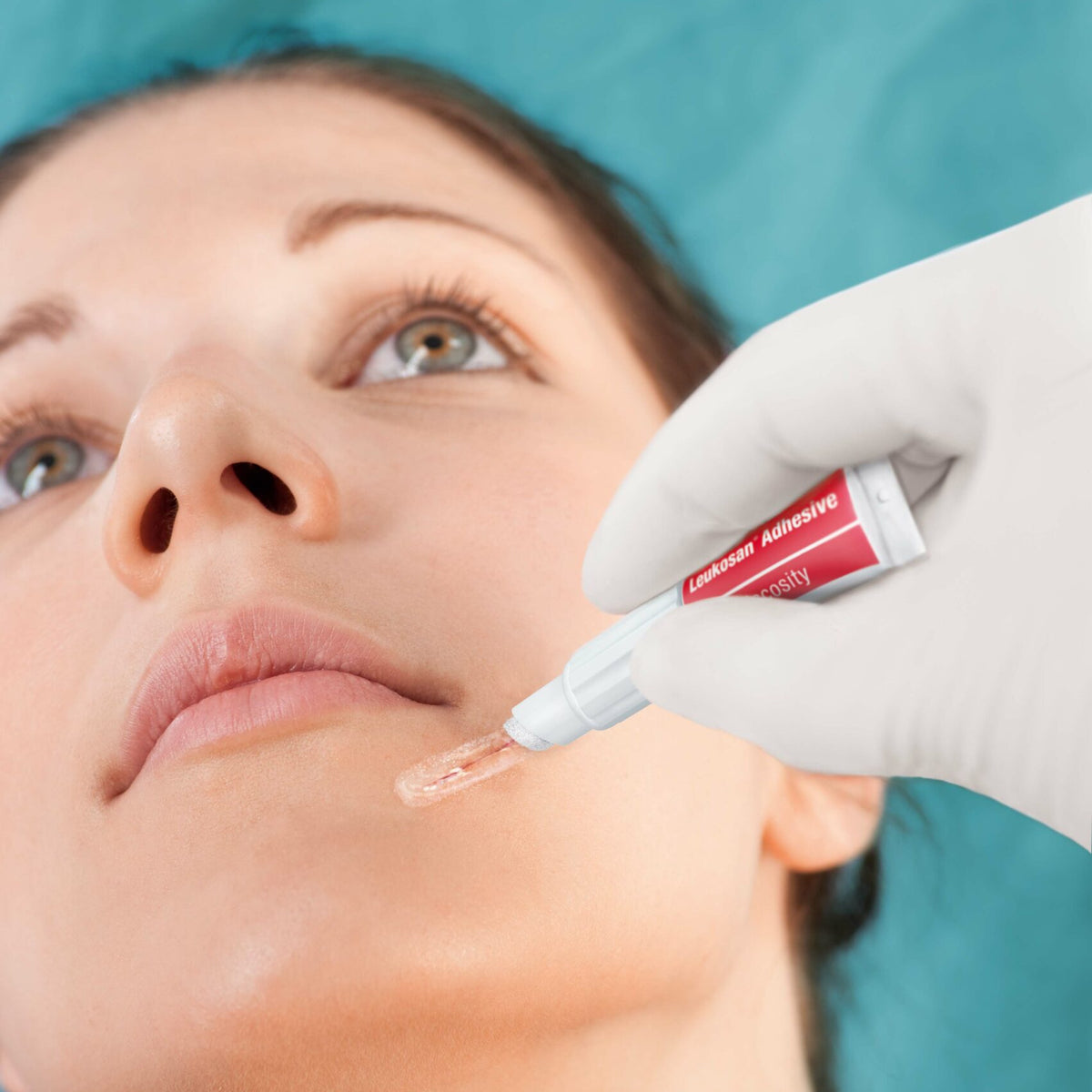 Adhesivo Tópico Para Piel - Leukosan Adhesive