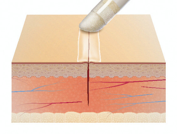 Adhesivo Tópico Para Piel - Leukosan Adhesive