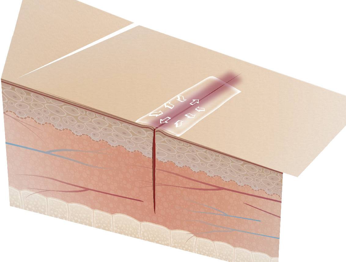 Adhesivo Tópico Para Piel - Leukosan Adhesive