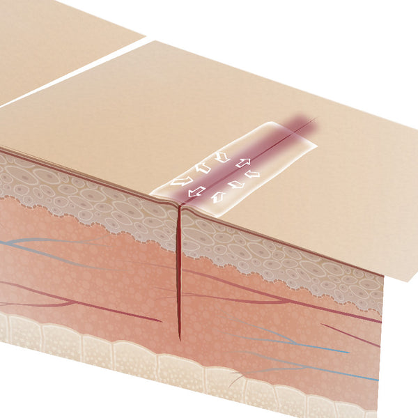 Adhesivo Tópico Para Piel - Leukosan Adhesive