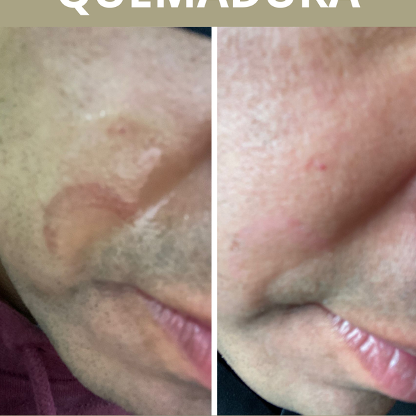 Crema Regeneradora y Protectora Natural Pielawén | Reparación Intensiva de la Piel – Chiloé